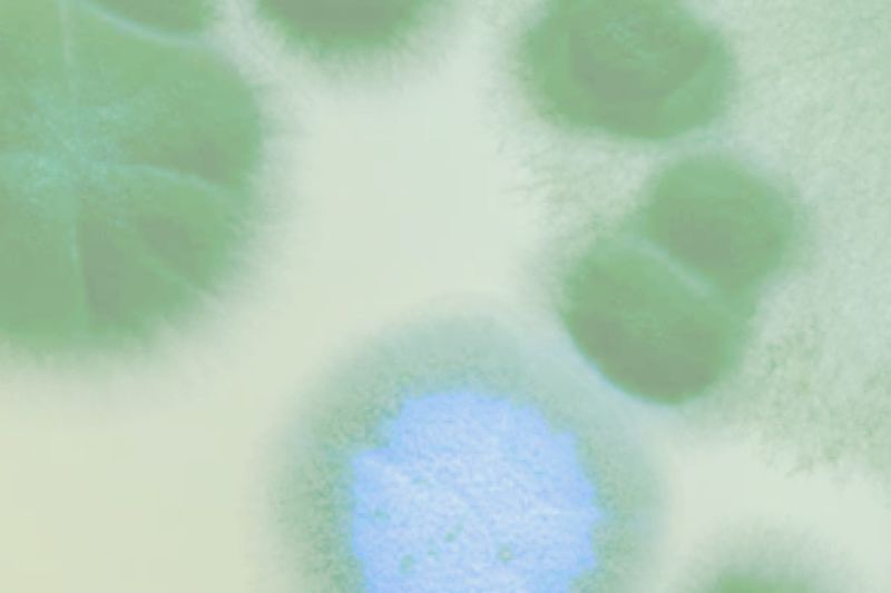 Trichomoniasis vs Yeast Infection What’s the Difference? Evvy